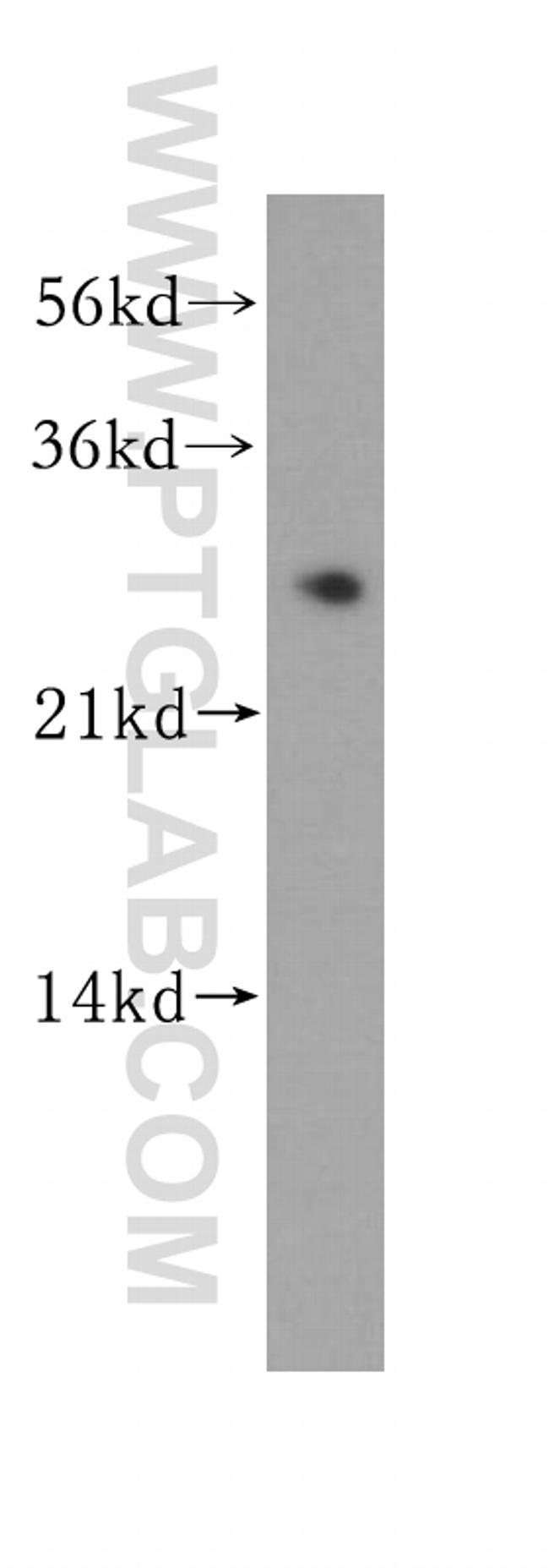 MMAB Antibody in Western Blot (WB)