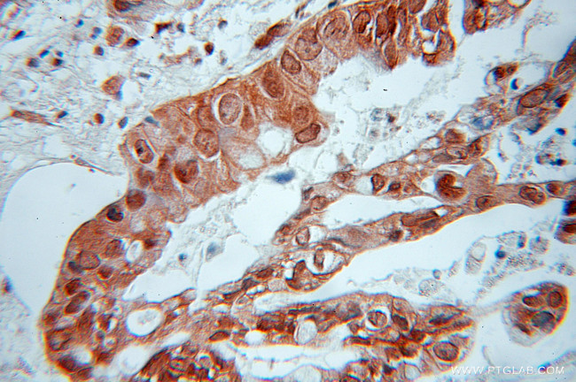 RIC8A Antibody in Immunohistochemistry (Paraffin) (IHC (P))