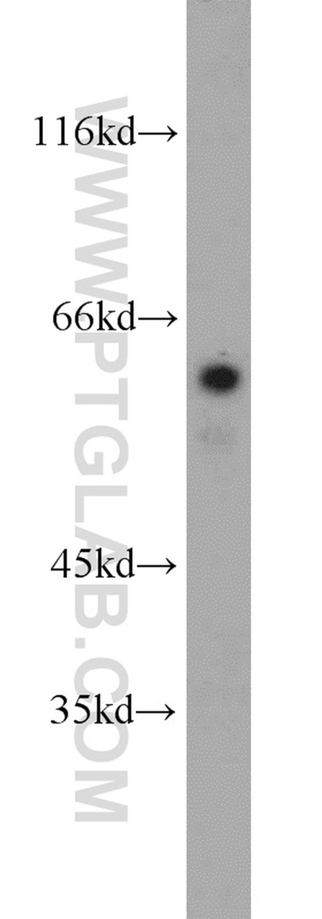 RIC8A Antibody in Western Blot (WB)