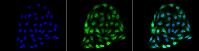 Hsp70 Antibody in Immunocytochemistry (ICC/IF)