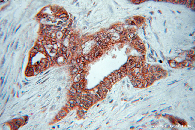 gamma catenin Antibody in Immunohistochemistry (Paraffin) (IHC (P))