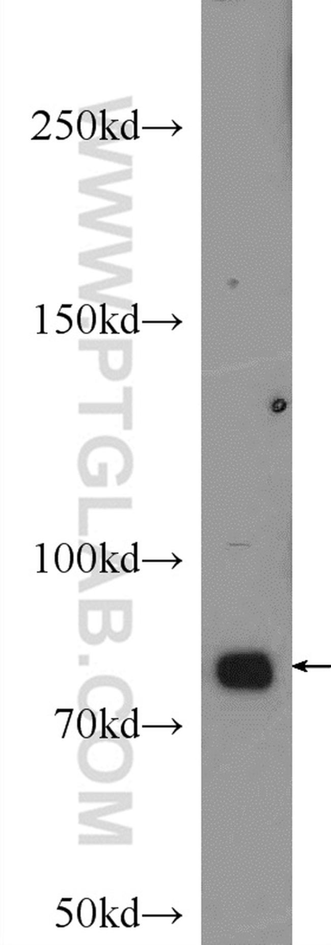 gamma catenin Antibody in Western Blot (WB)