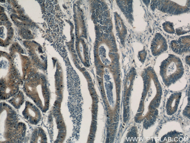 gamma catenin Antibody in Immunohistochemistry (Paraffin) (IHC (P))