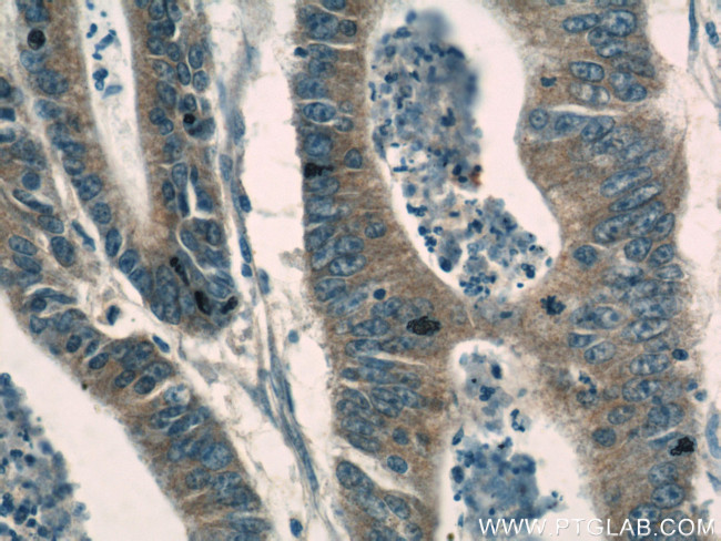 gamma catenin Antibody in Immunohistochemistry (Paraffin) (IHC (P))