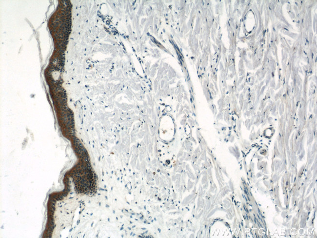 gamma catenin Antibody in Immunohistochemistry (Paraffin) (IHC (P))