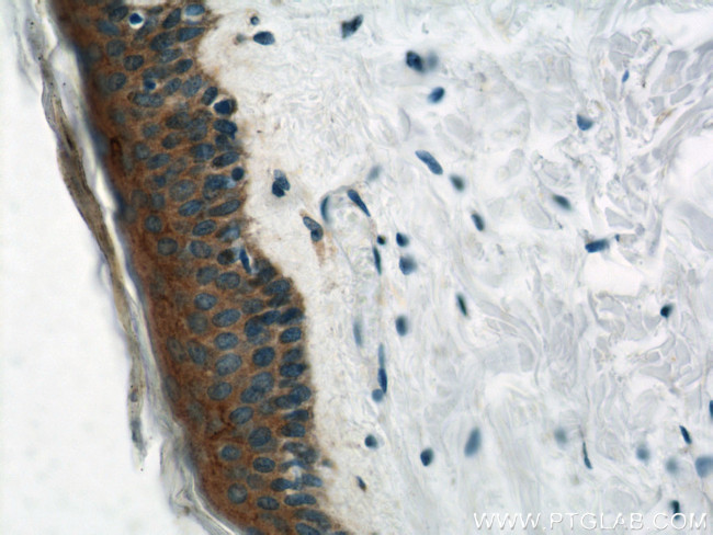 gamma catenin Antibody in Immunohistochemistry (Paraffin) (IHC (P))