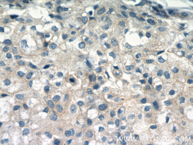 gamma catenin Antibody in Immunohistochemistry (Paraffin) (IHC (P))