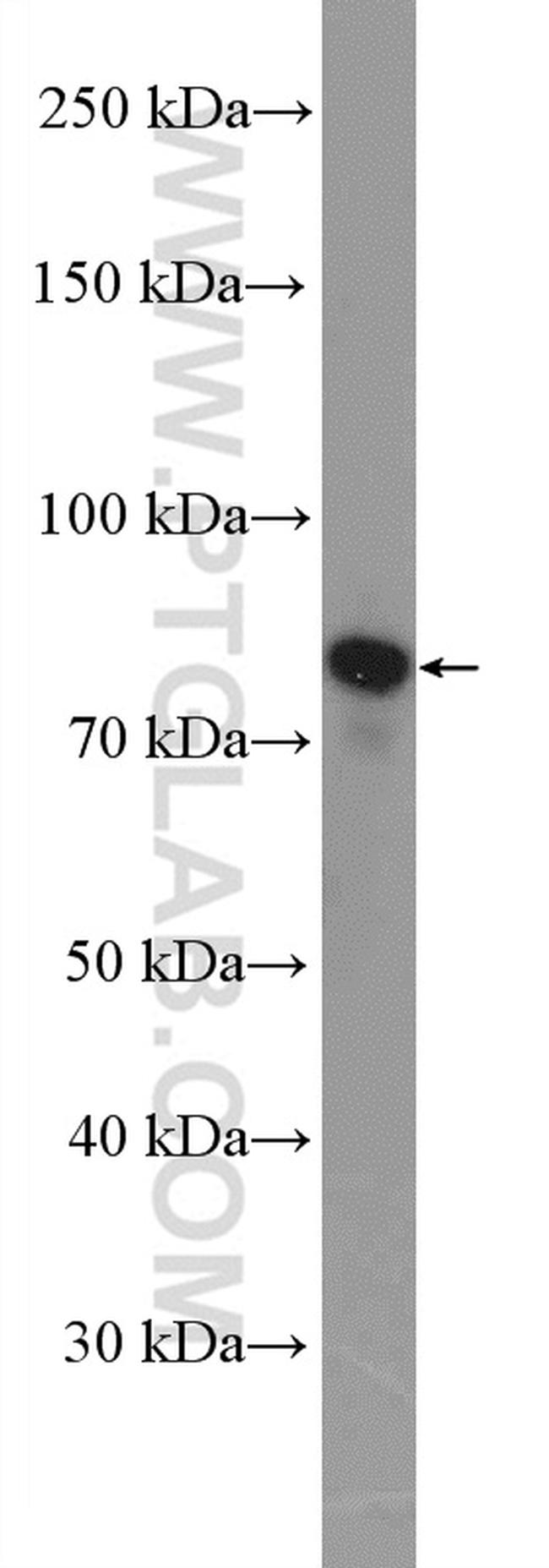 gamma catenin Antibody in Western Blot (WB)