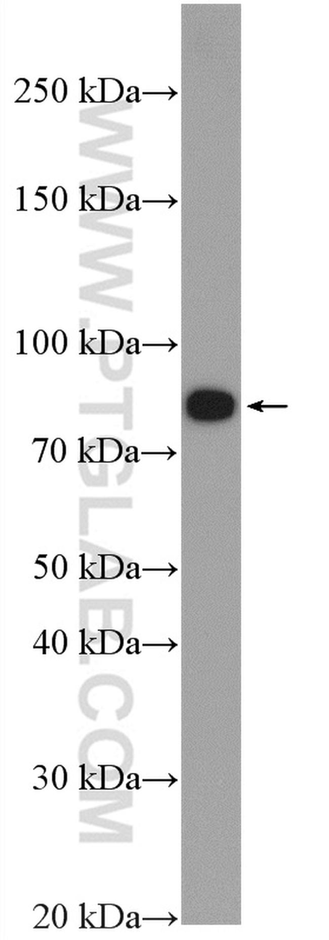 gamma catenin Antibody in Western Blot (WB)