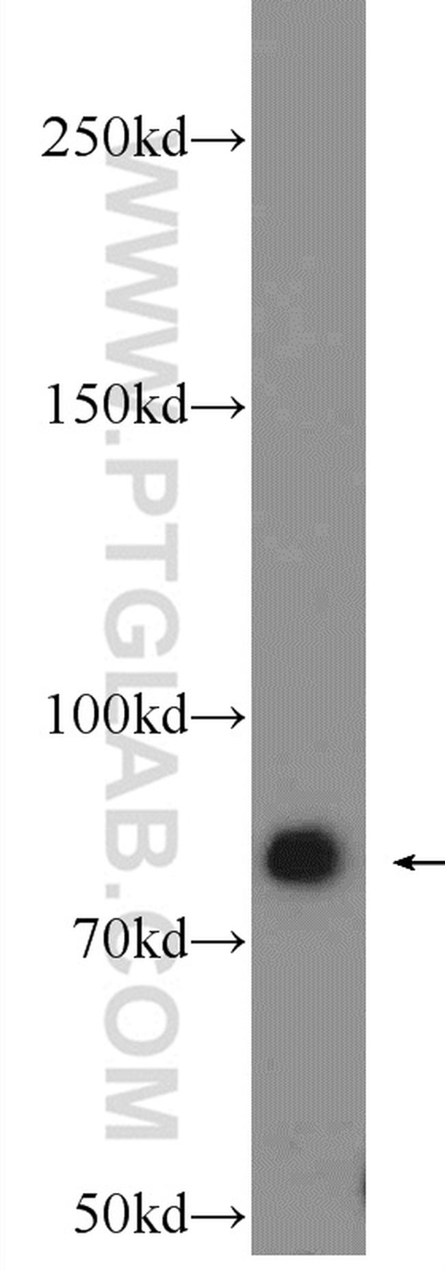 gamma catenin Antibody in Western Blot (WB)