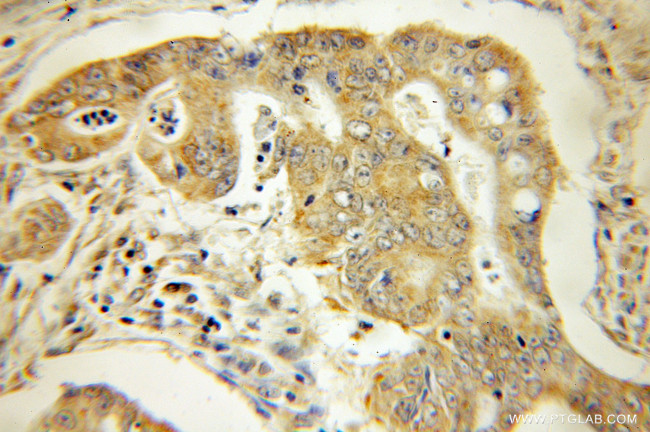 SEC61G Antibody in Immunohistochemistry (Paraffin) (IHC (P))