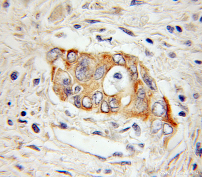 Hephaestin Antibody in Immunohistochemistry (Paraffin) (IHC (P))