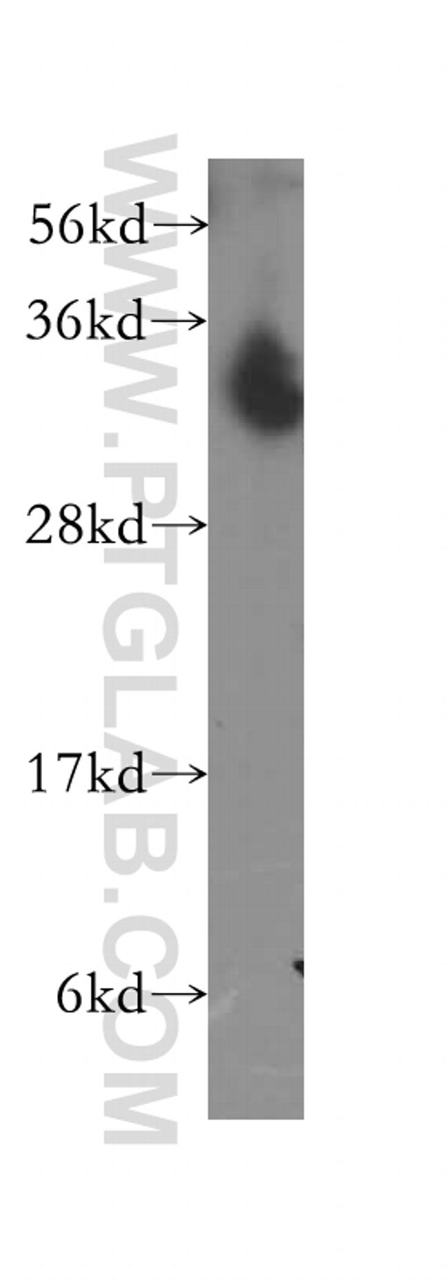 NTHL1 Antibody in Western Blot (WB)