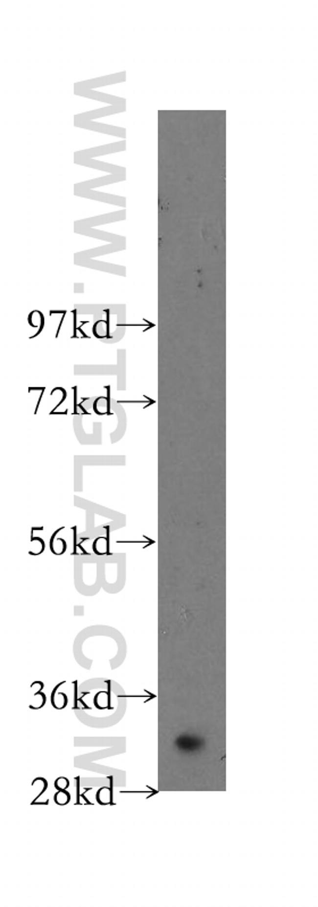 NTHL1 Antibody in Western Blot (WB)