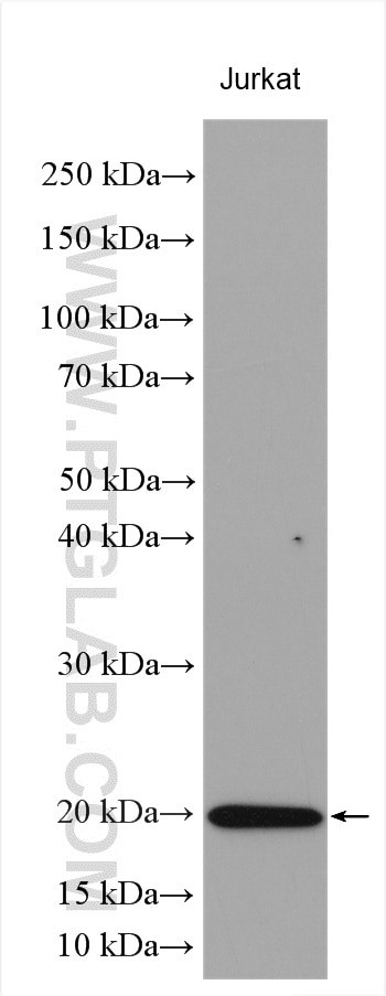 Stathmin 1 Antibody in Western Blot (WB)