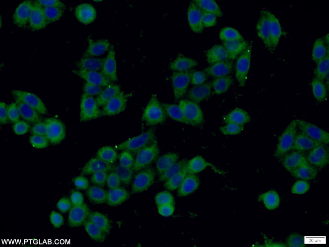 Stathmin 1 Antibody in Immunocytochemistry (ICC/IF)