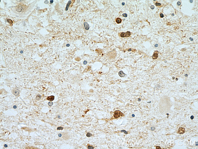 Stathmin 1 Antibody in Immunohistochemistry (Paraffin) (IHC (P))