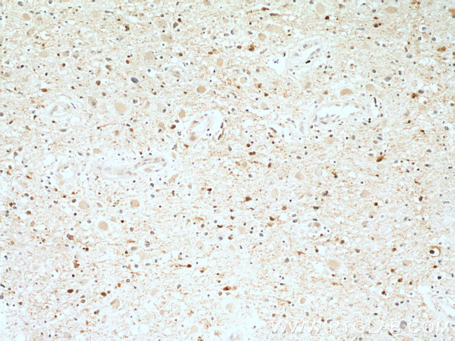 Stathmin 1 Antibody in Immunohistochemistry (Paraffin) (IHC (P))