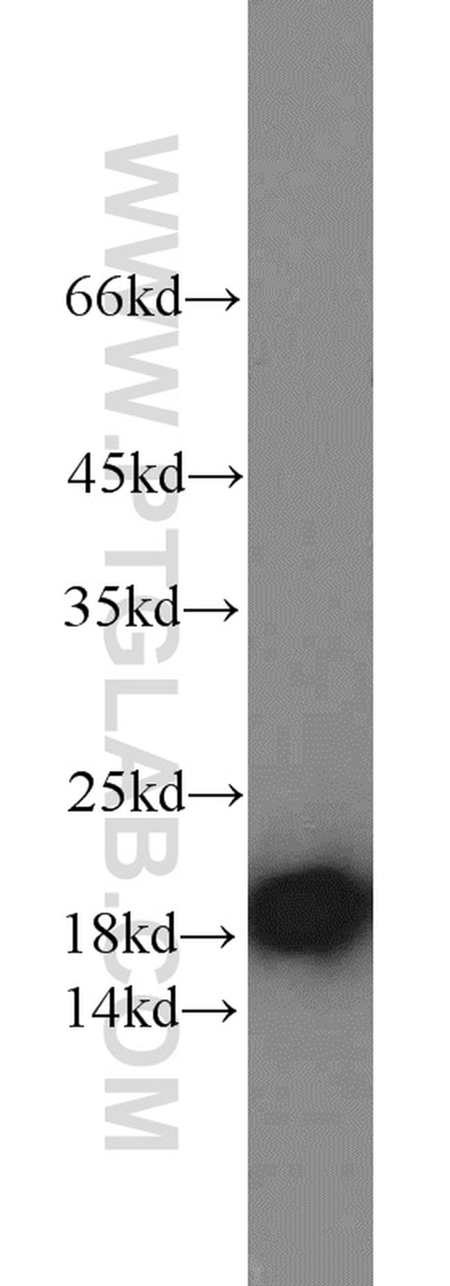 Stathmin 1 Antibody in Western Blot (WB)