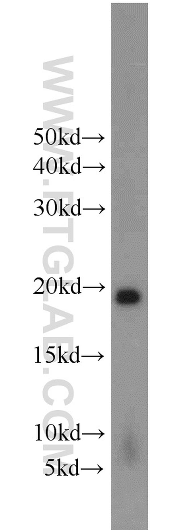 Stathmin 1 Antibody in Western Blot (WB)