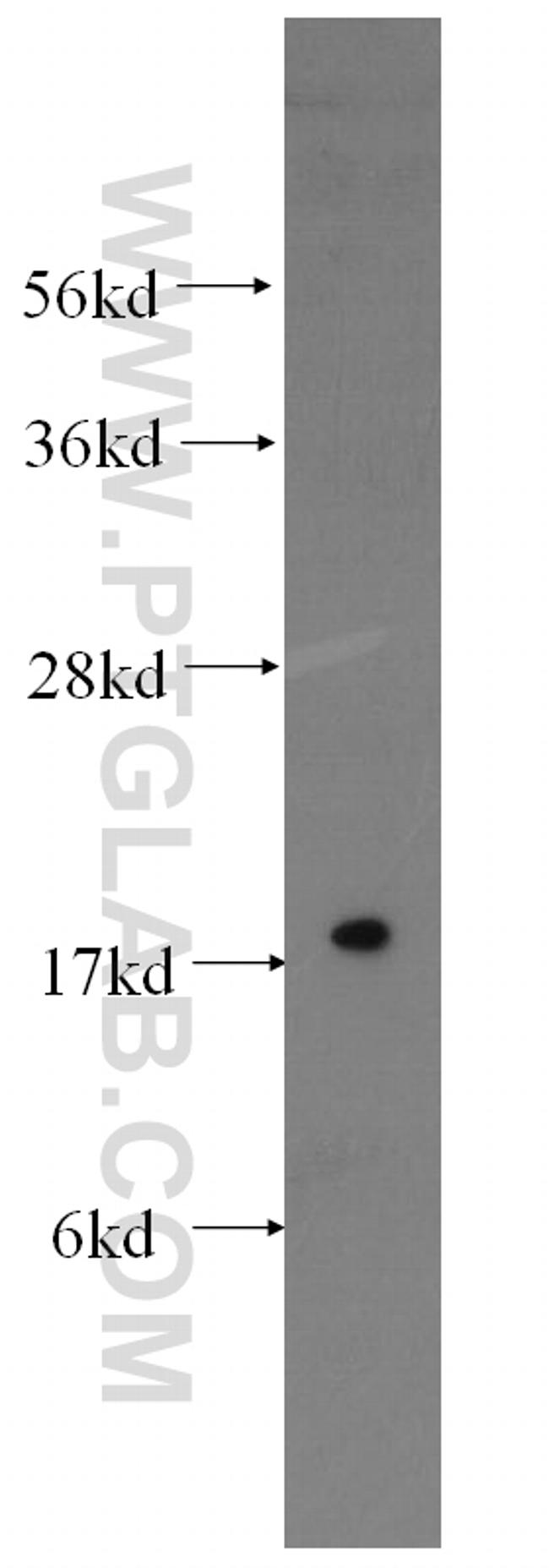 Stathmin 1 Antibody in Western Blot (WB)