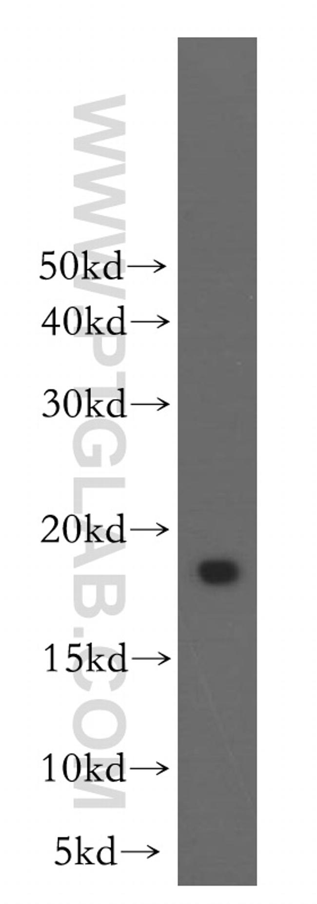 Stathmin 1 Antibody in Western Blot (WB)