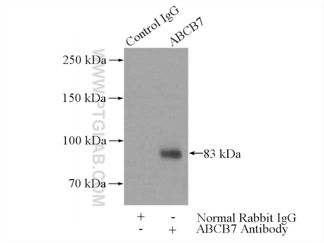 ABCB7 Antibody in Immunoprecipitation (IP)