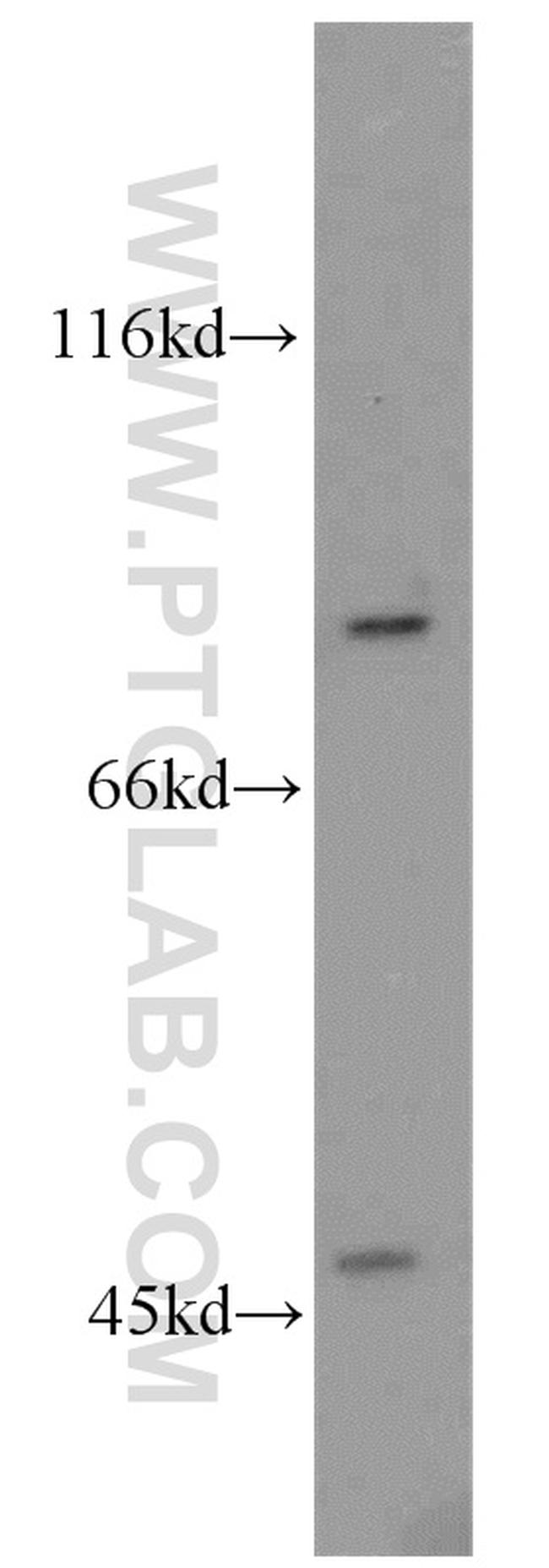 ABCB7 Antibody in Western Blot (WB)