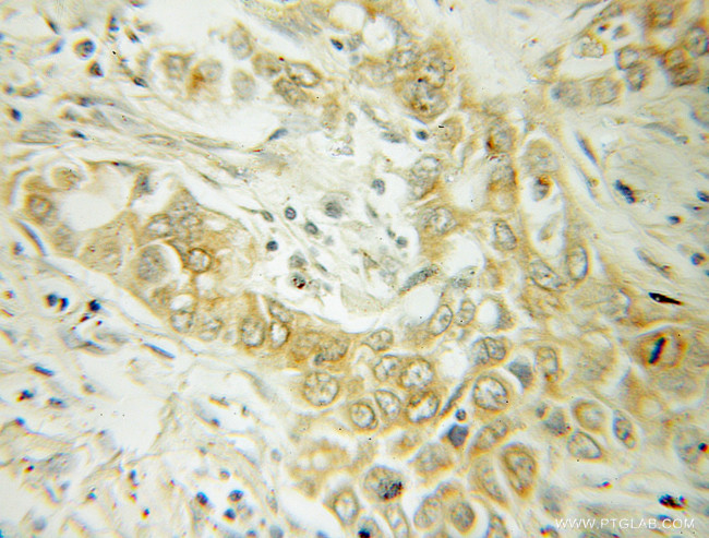 ABCD1 Antibody in Immunohistochemistry (Paraffin) (IHC (P))