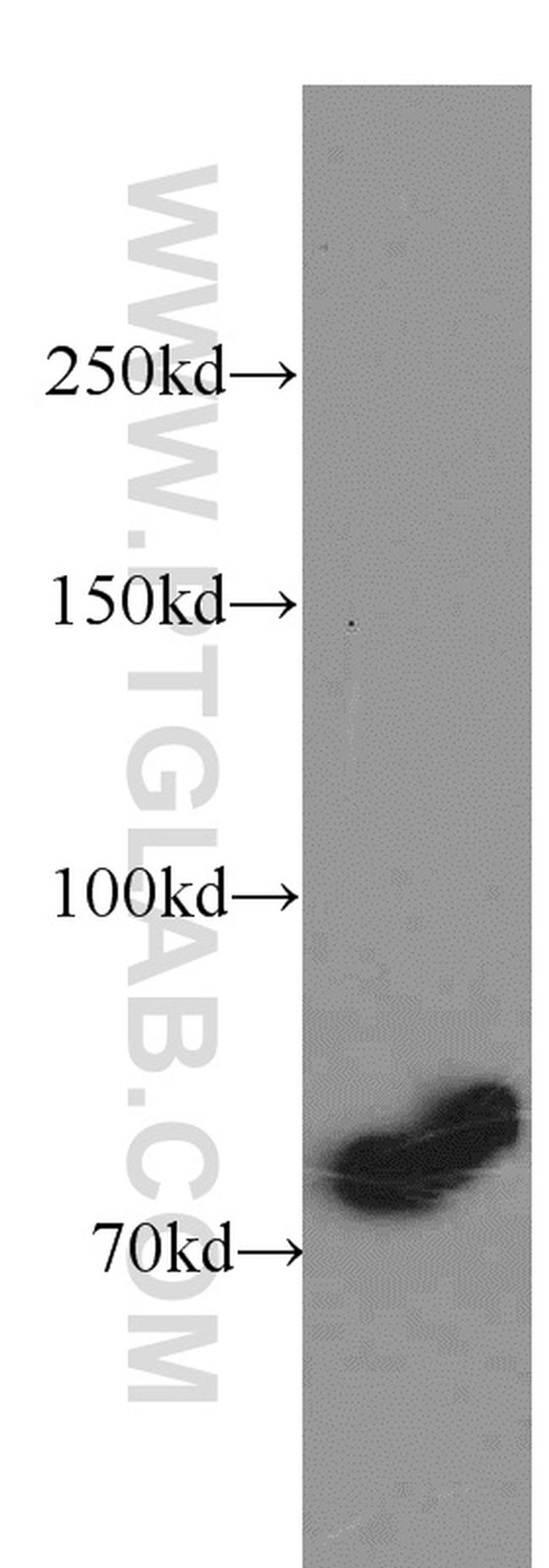 ABCD1 Antibody in Western Blot (WB)