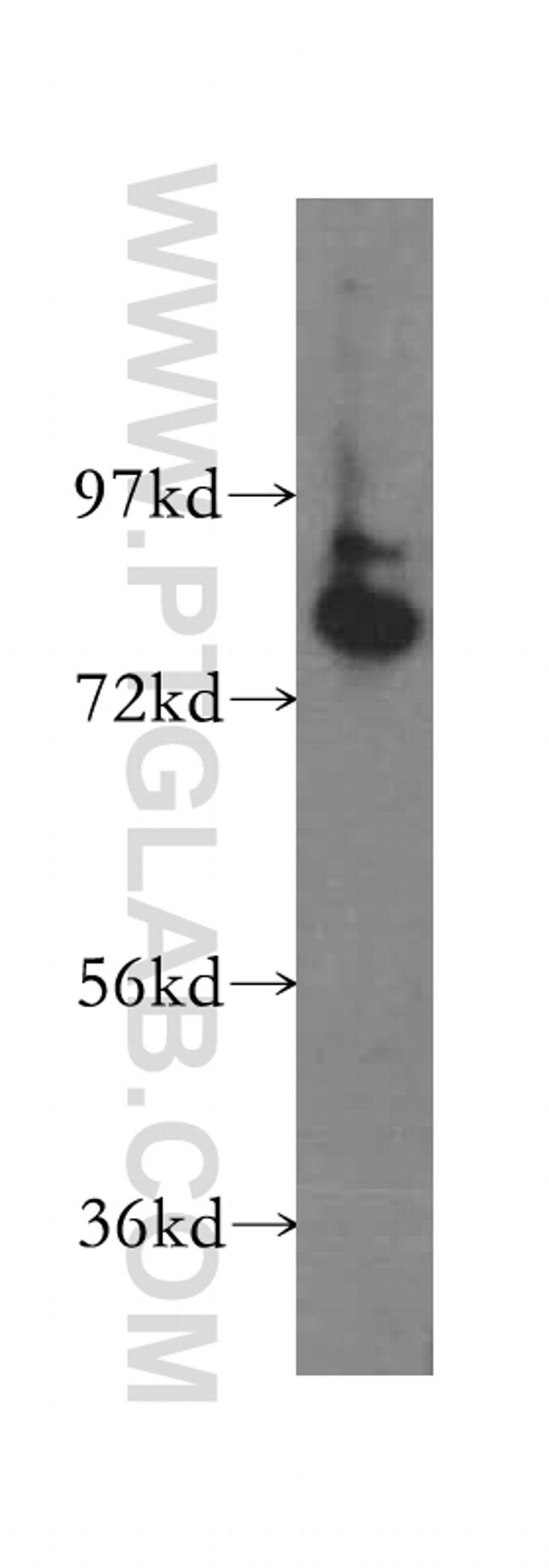 ABCD1 Antibody in Western Blot (WB)