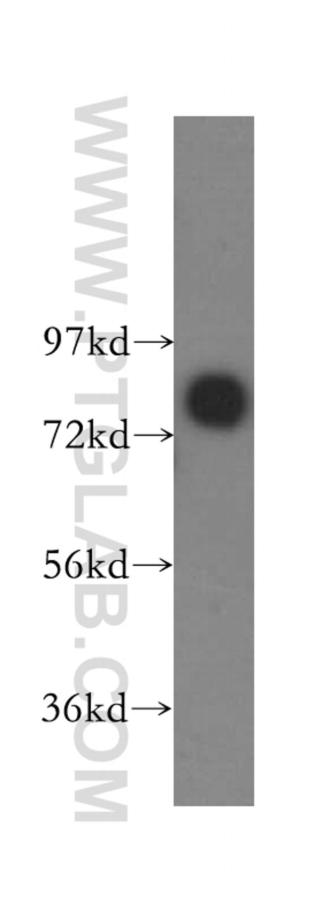 ABCD1 Antibody in Western Blot (WB)