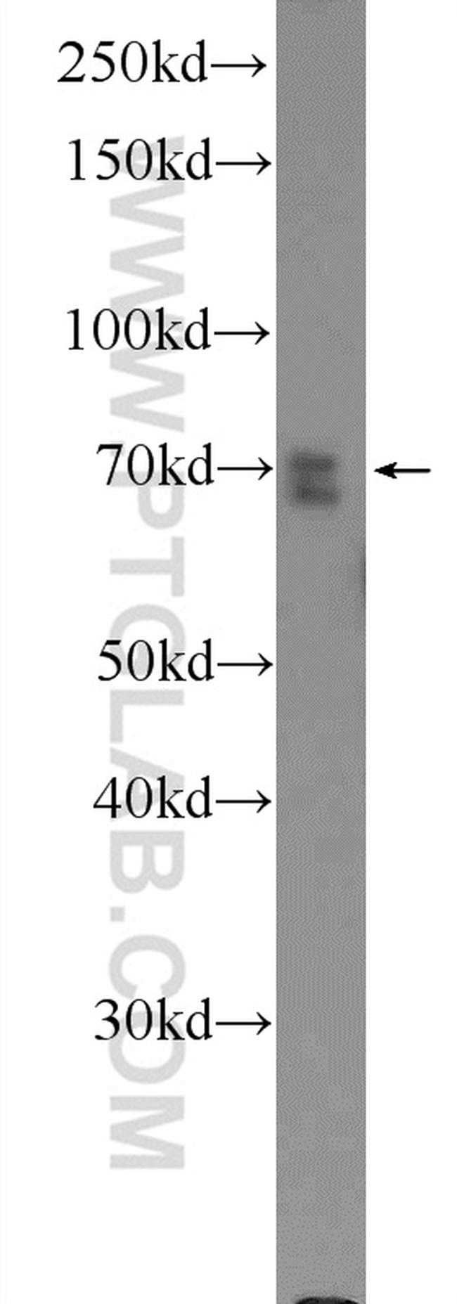 MAPK7 Antibody in Western Blot (WB)