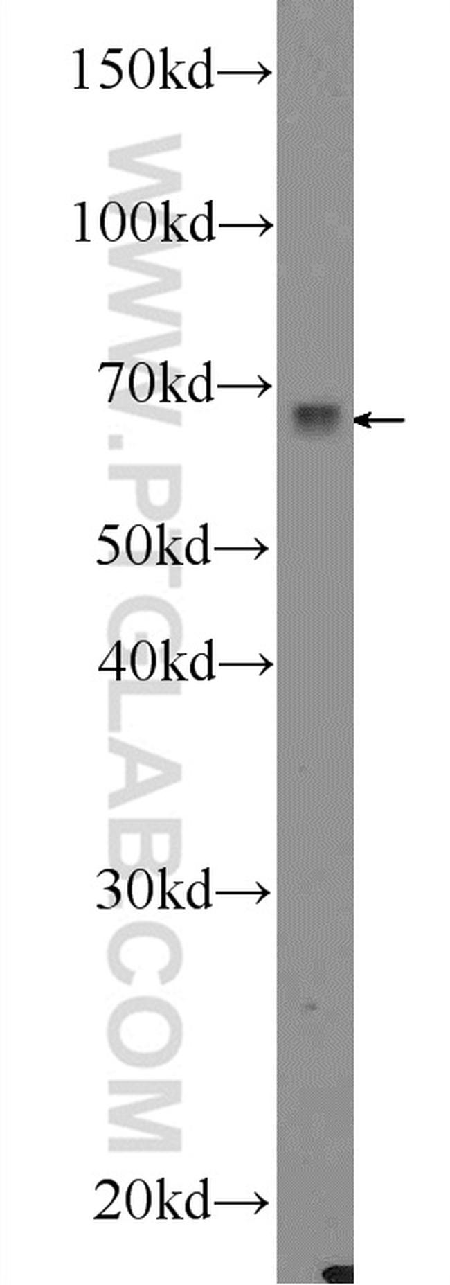 MAPK7 Antibody in Western Blot (WB)