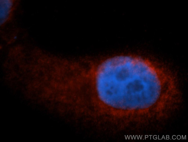 EIF3G Antibody in Immunocytochemistry (ICC/IF)