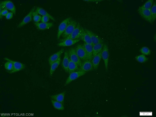 EIF3G Antibody in Immunocytochemistry (ICC/IF)