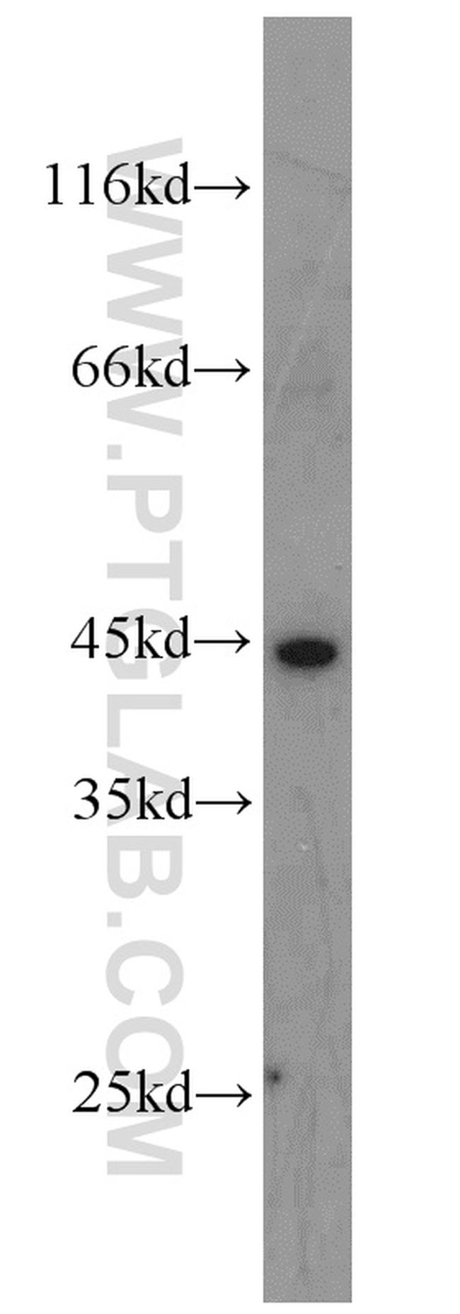 EIF3G Antibody in Western Blot (WB)