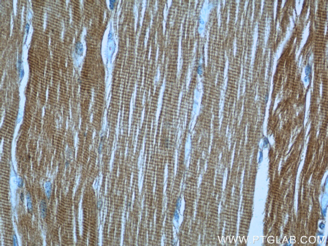 RTN2 Antibody in Immunohistochemistry (Paraffin) (IHC (P))