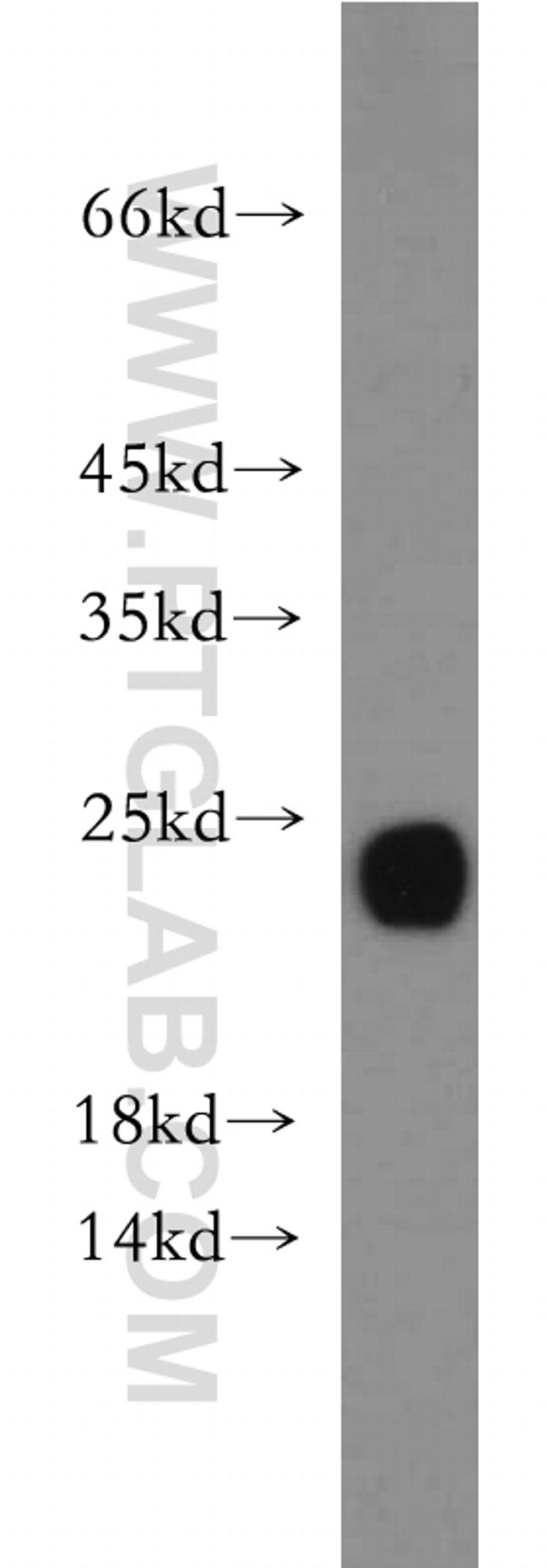 RTN2 Antibody in Western Blot (WB)