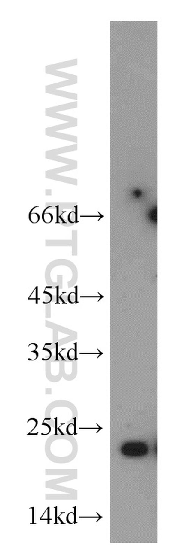 RTN2 Antibody in Western Blot (WB)