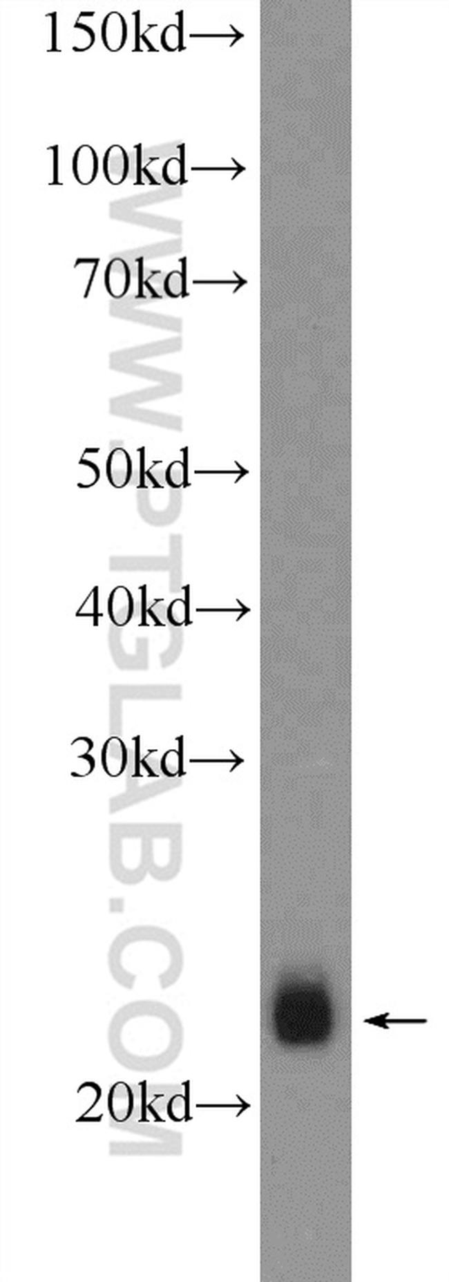 RTN2 Antibody in Western Blot (WB)