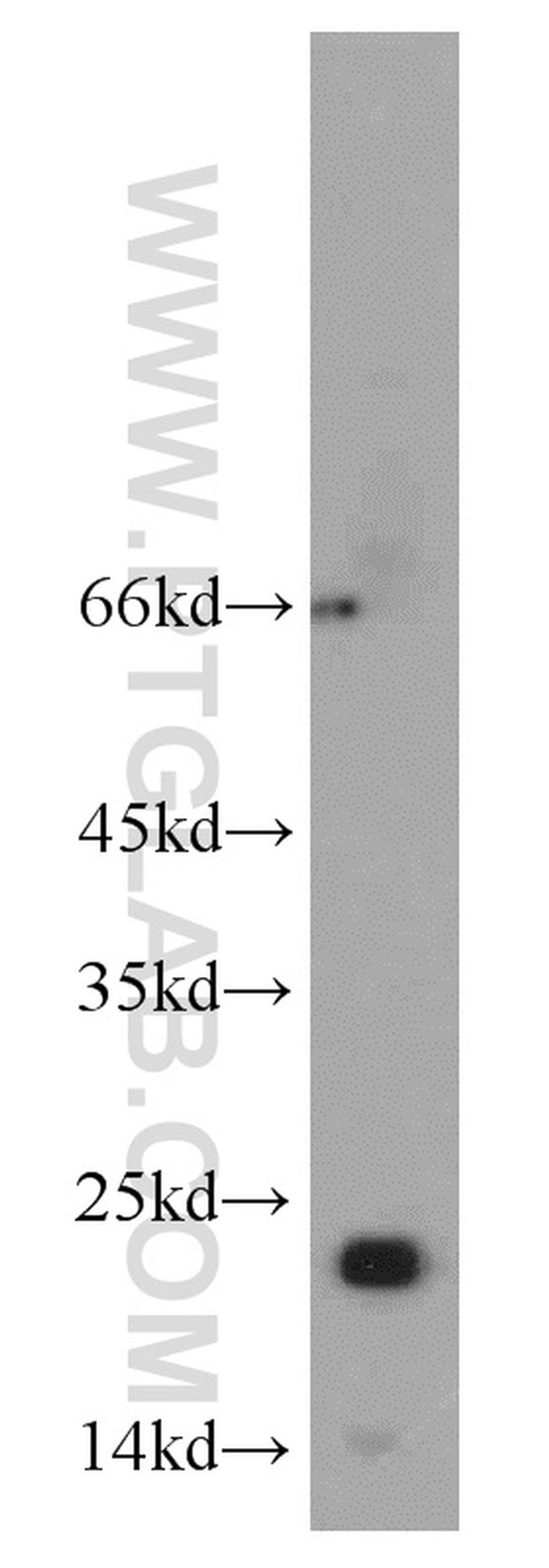 RTN2 Antibody in Western Blot (WB)