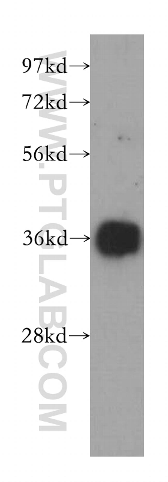 EIF2S1 Antibody in Western Blot (WB)