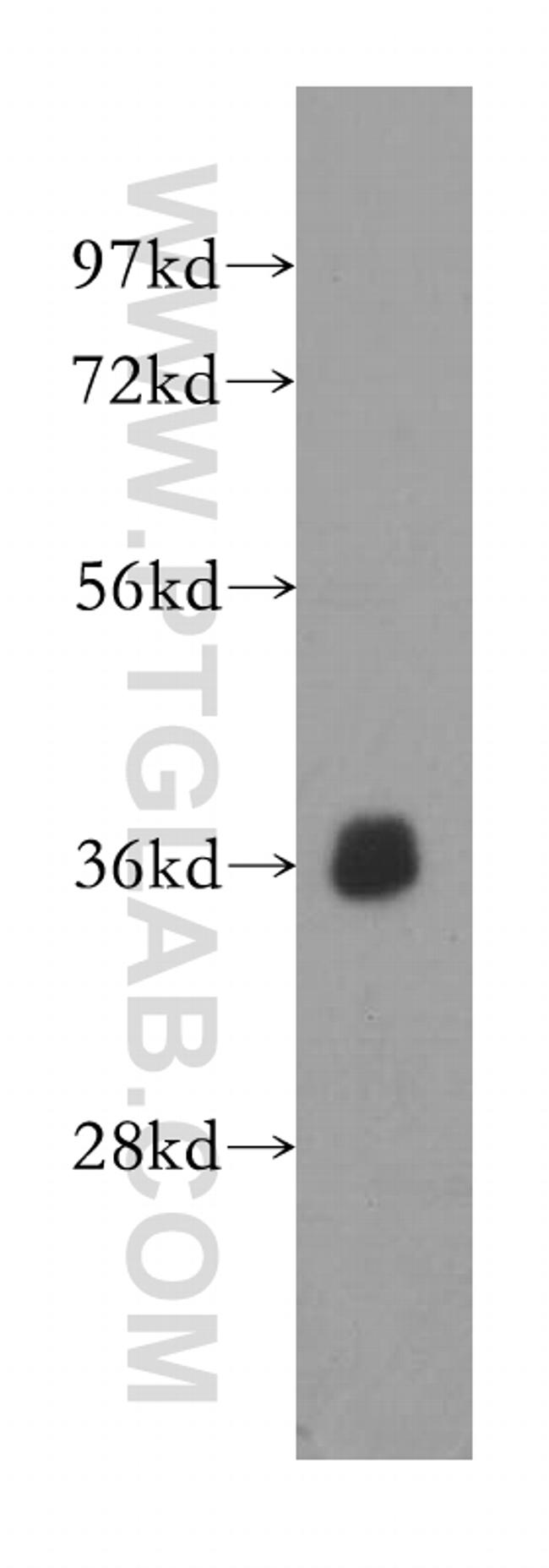 EIF2S1 Antibody in Western Blot (WB)