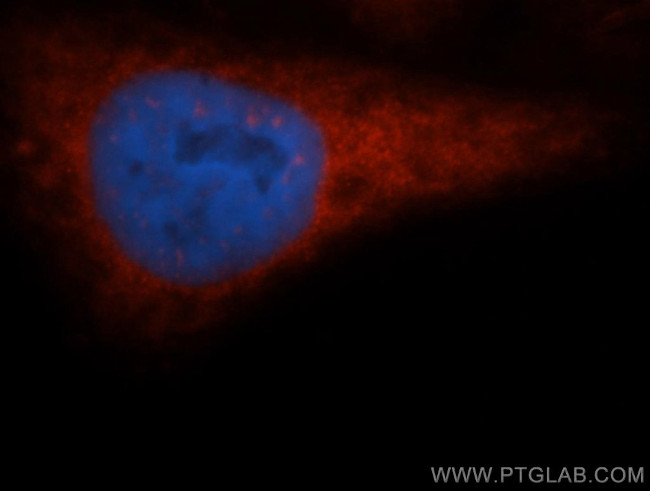 EIF2S1 Antibody in Immunocytochemistry (ICC/IF)