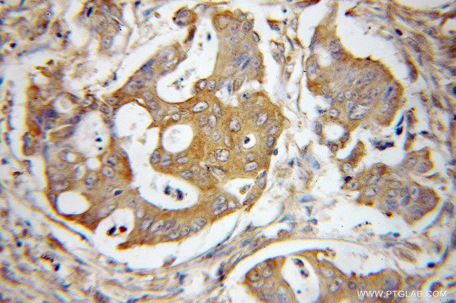 EIF2S1 Antibody in Immunohistochemistry (Paraffin) (IHC (P))