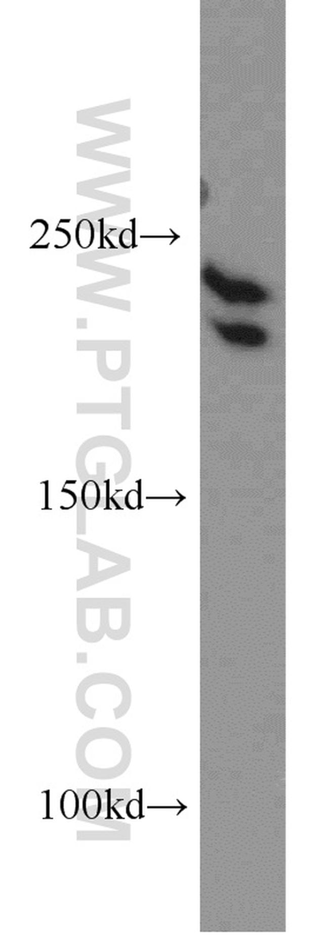 PRPF8 Antibody in Western Blot (WB)