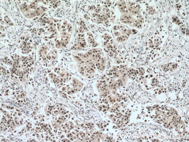 EAF2 Antibody in Immunohistochemistry (Paraffin) (IHC (P))