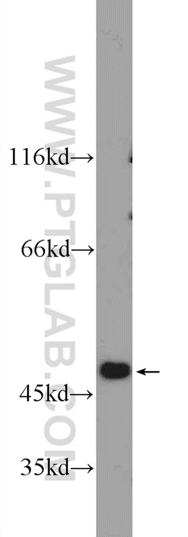 EAF2 Antibody in Western Blot (WB)