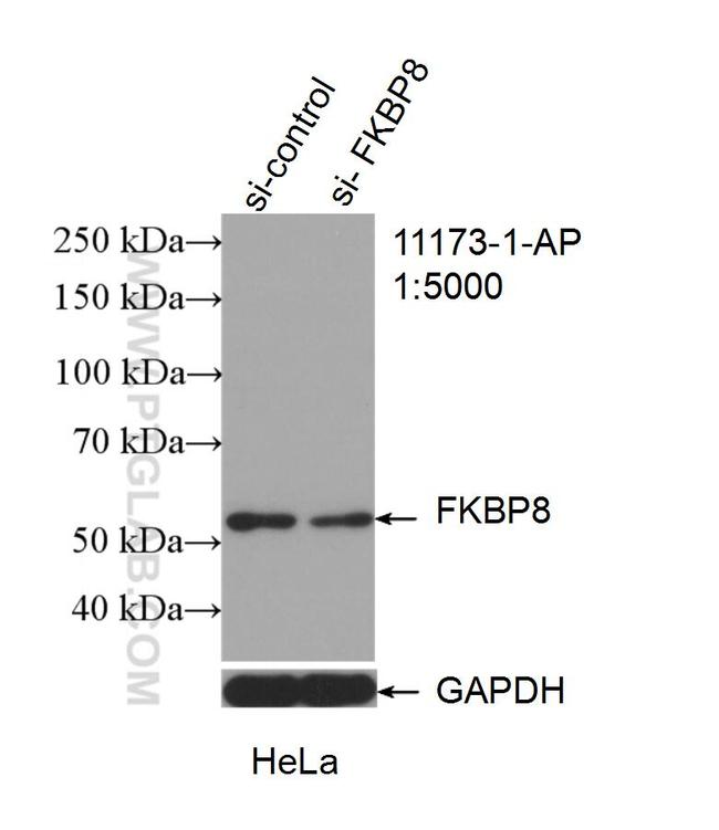 FKBP8 Antibody in Western Blot (WB)